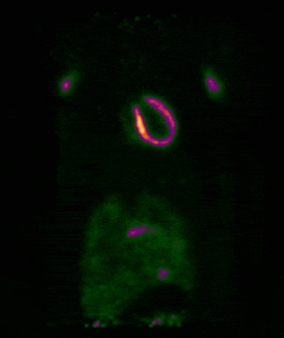 PET_Cardiac_Gating (1)